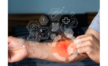 Rimedi naturali per eritemi e scottature solari